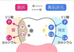 脱灰と再石灰化